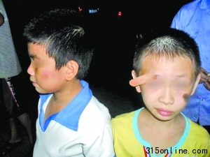 8歲學生稱遭老師扇耳光致眉角開裂皮肉外翻(圖)