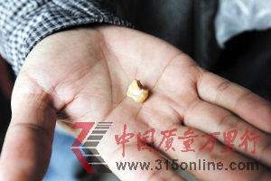 王大爺說,這顆牙齒就是從這盒餅干中吃出來的。 王大爺說,這顆牙齒就是從這盒餅干中吃出來的。