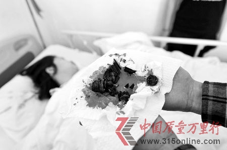 經過搶救后,女子脫離了生命危險,但依然非常虛弱,連說話的力氣也沒有。醫生在手術中,從該女子體內取出一二十塊碎片,其中包括鐵環、螺絲和大塑料塊等,觸目驚心。 CFP 經過搶救后,女子脫離了生命危險,但依然非常虛弱,連說話的力氣也沒有。醫生在手術中,從該女子體內取出一二十塊碎片,其中包括鐵環、螺絲和大塑料塊等,觸目驚心。 CFP